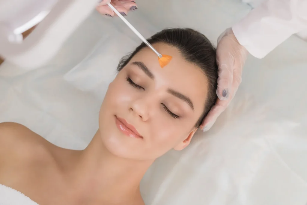 Chemical Peels in Massapequa, NY at Haven Aesthetics & Laser