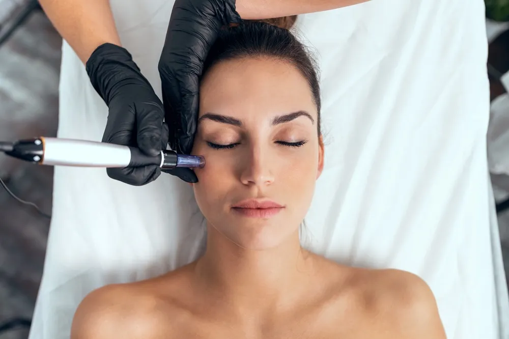 Medical Microneedling in Massapequa, NY at Haven Aesthetics & Laser