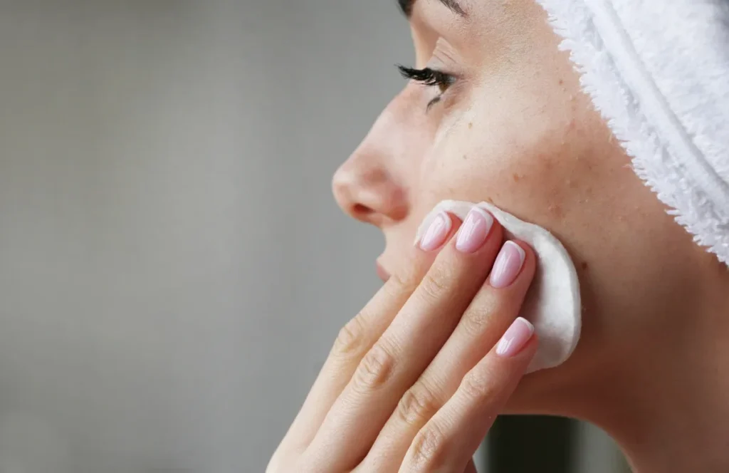 Laser for Acne in Massapequa, NY at Haven Aesthetics & Laser