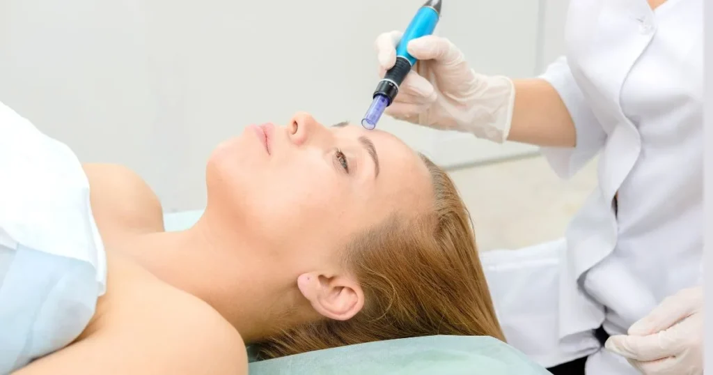 performing microneedling (collagen induction therapy) on a woman's face to treat fine lines and wrinkles.