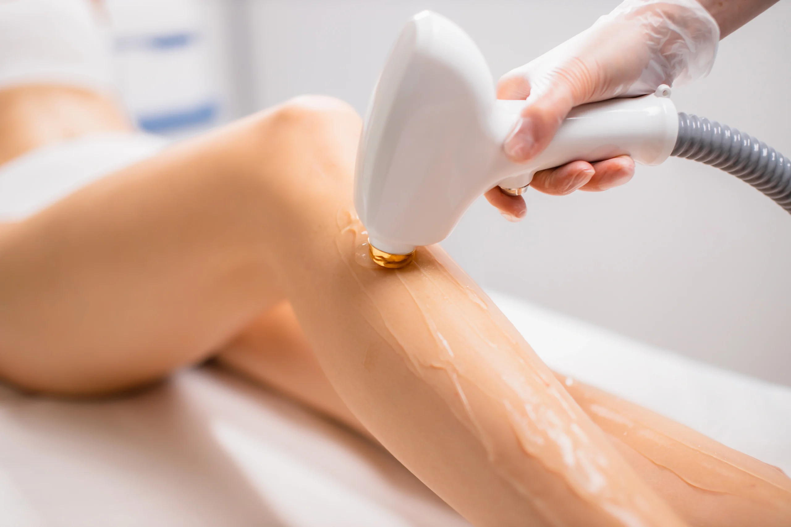 Laser Hair Removal vs. Waxing: Which Is Better Long-Term?